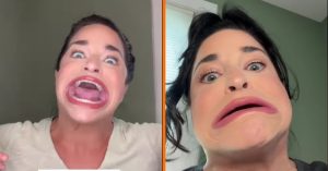 Guinness World Record-houder voor grootste mond vestigt nieuw record