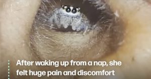 Schattig spinnetje woonde in vrouw's oor
