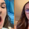 Stralende glimlach: Vrouw deelt haar nieuwe tanden met de wereld