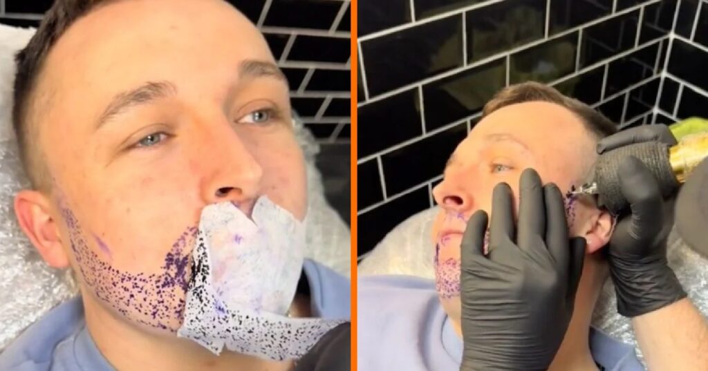 Man laat baard tatoeëren, maar het resultaat is niet wat hij verwachtte