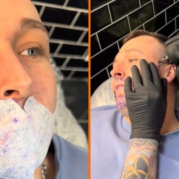 Man laat baard tatoeëren, maar het resultaat is niet wat hij verwachtte