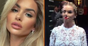 Wat is er gebeurd met het gezicht van Sarah van Soelen?