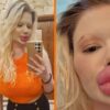 Bulgaarse influencer met 'grootste lippen ter wereld' kan geen liefde vinden