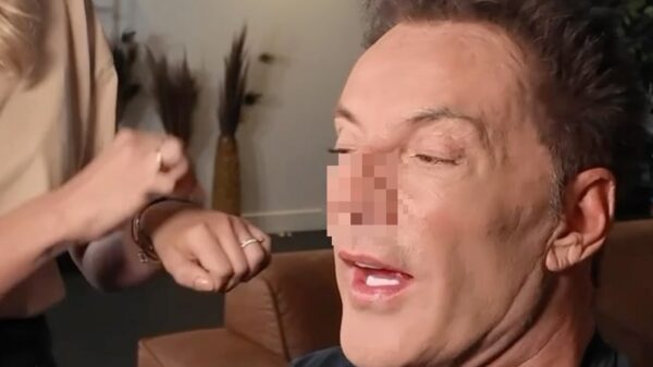 Volgers roepen allemaal hetzelfde om video Gerard Joling: 'Wat is er met je neus gebeurd?!'