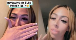 Tanden laten doen in Turkije