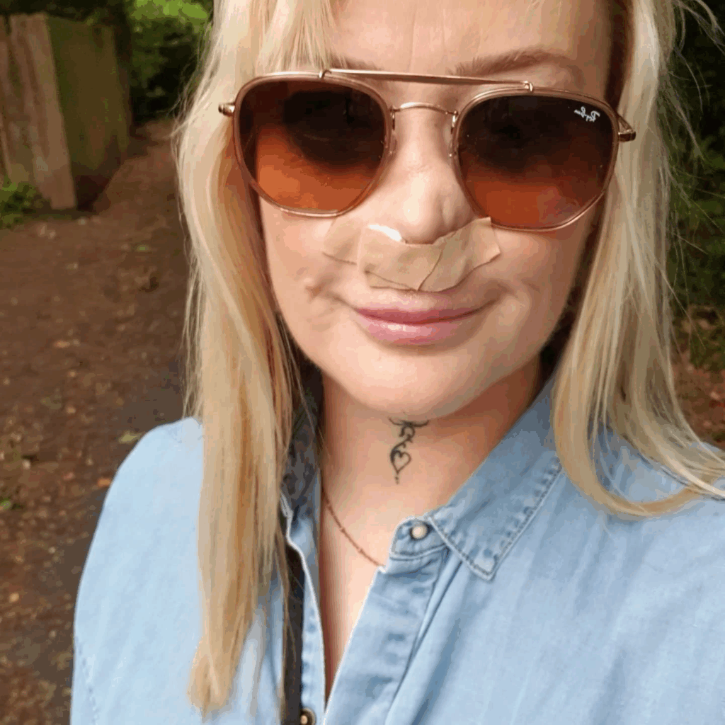 Tanden implanteren in Turkije