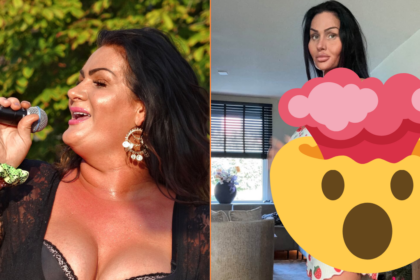 Louisa Janssen toont gigantisch gewichtsverlies na Ozempic kuur: ‘Je bent te ver gegaan!’